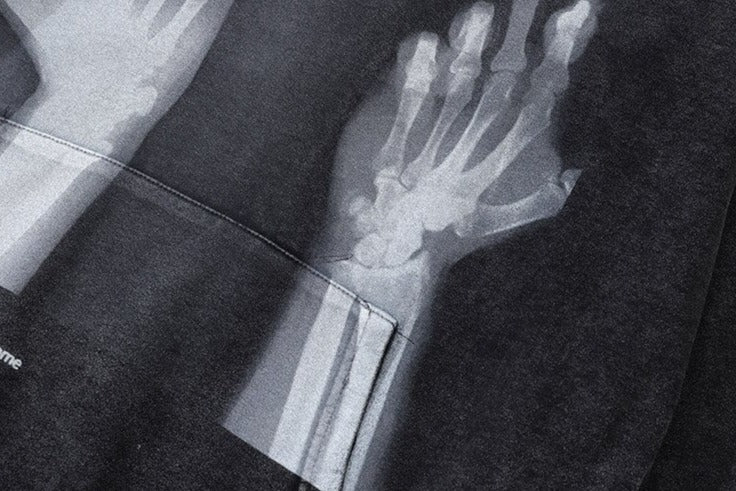 F You X-ray Hoodies